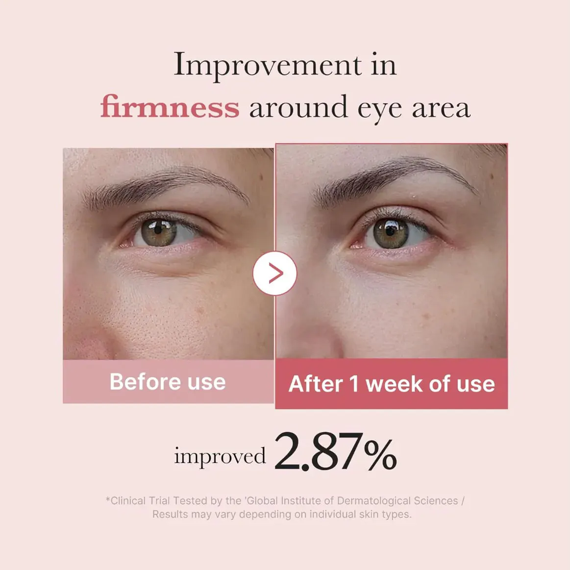 Medicube PDRN Pink Peptide Eye Cream 30ml, view 3