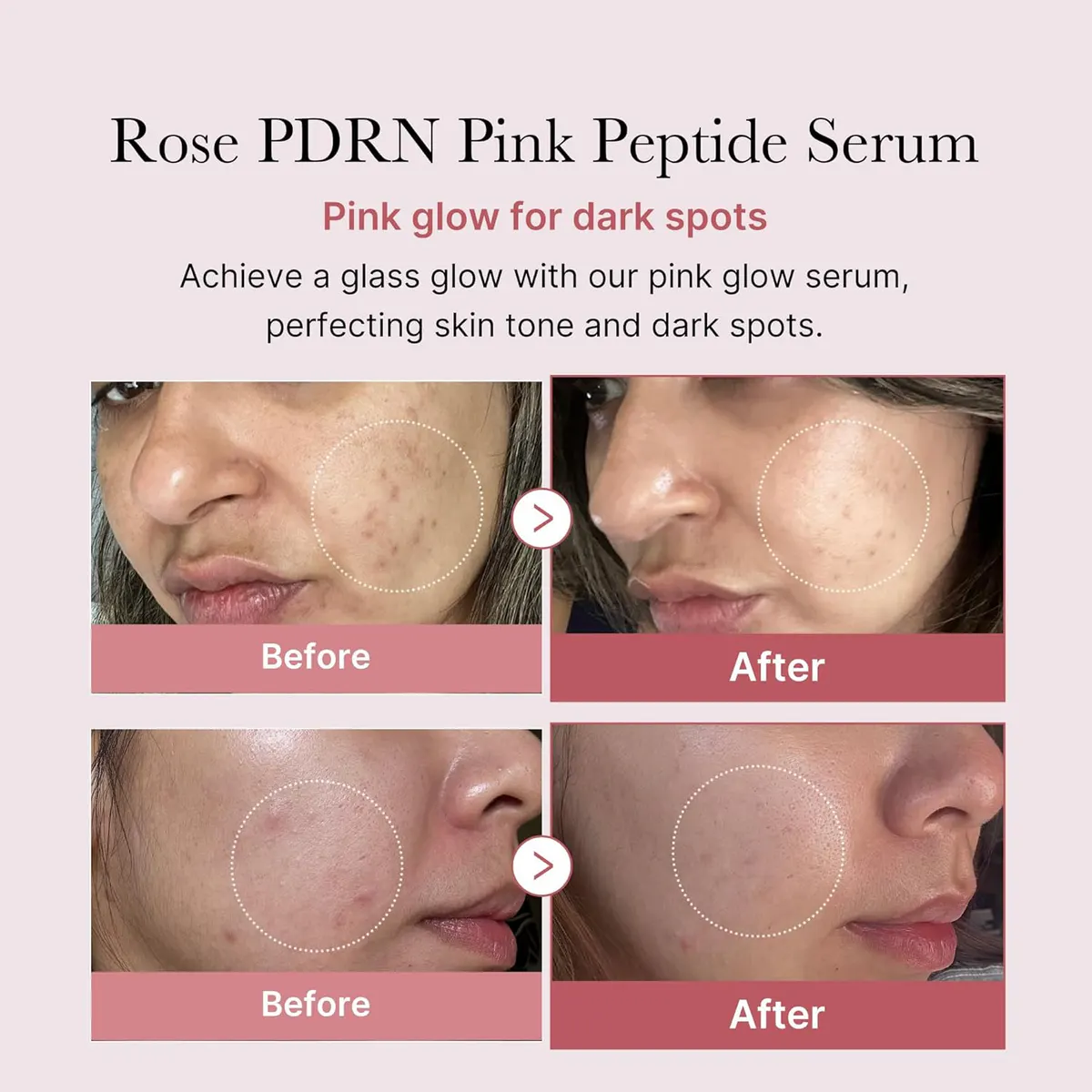 Medicube PDRN Pink Peptide Serum 30ml Duo Bundle, view 3