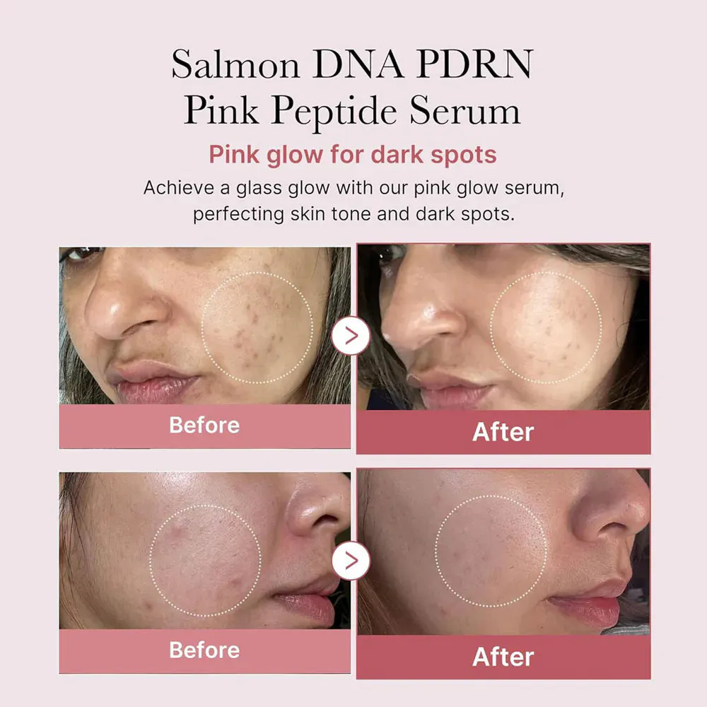 Medicube PDRN Pink Peptide Serum Refill Pack, view 2