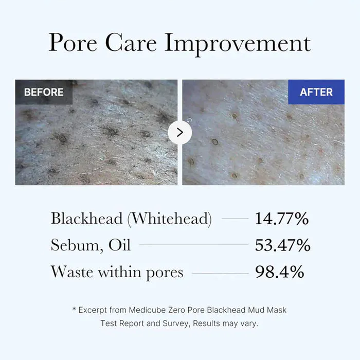 Medicube Zero Pore Blackhead Mud Mask 100g, view 4