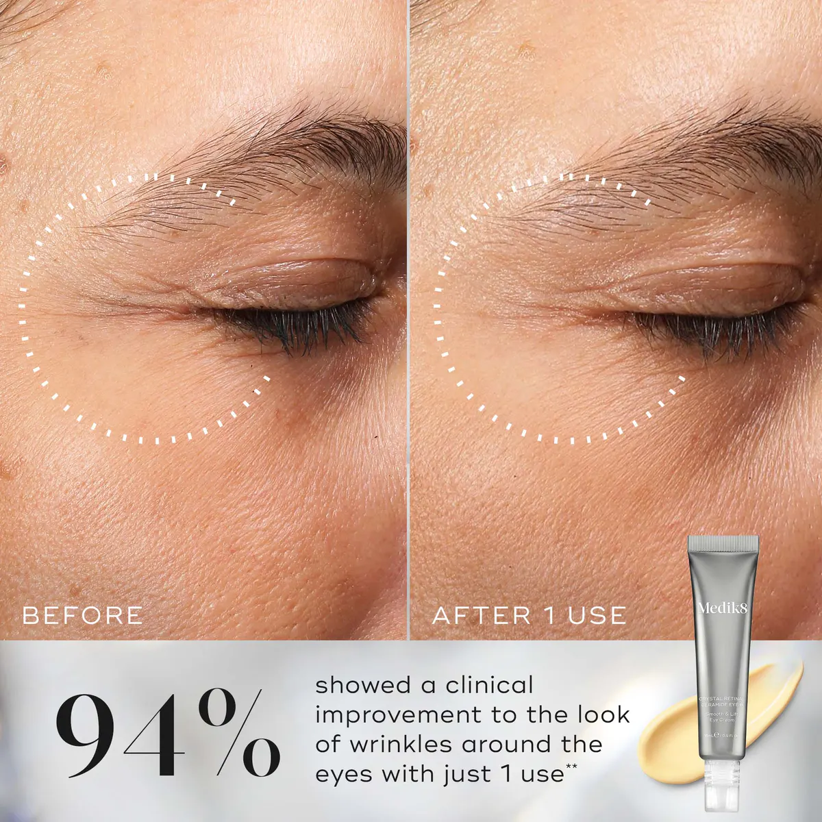 Medik8 Crystal Retinal Ceramide Eye 3 15ml, view 3