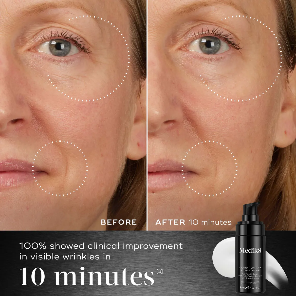 Medik8 Liquid Peptides Advanced MP 30ml, view 2