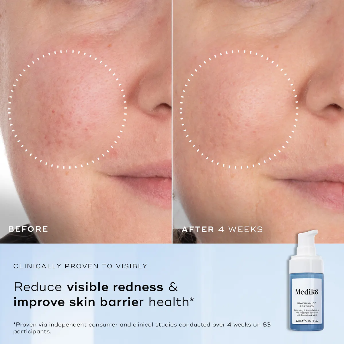 Medik8 Niacinamide Peptides Serum 30ml, view 4