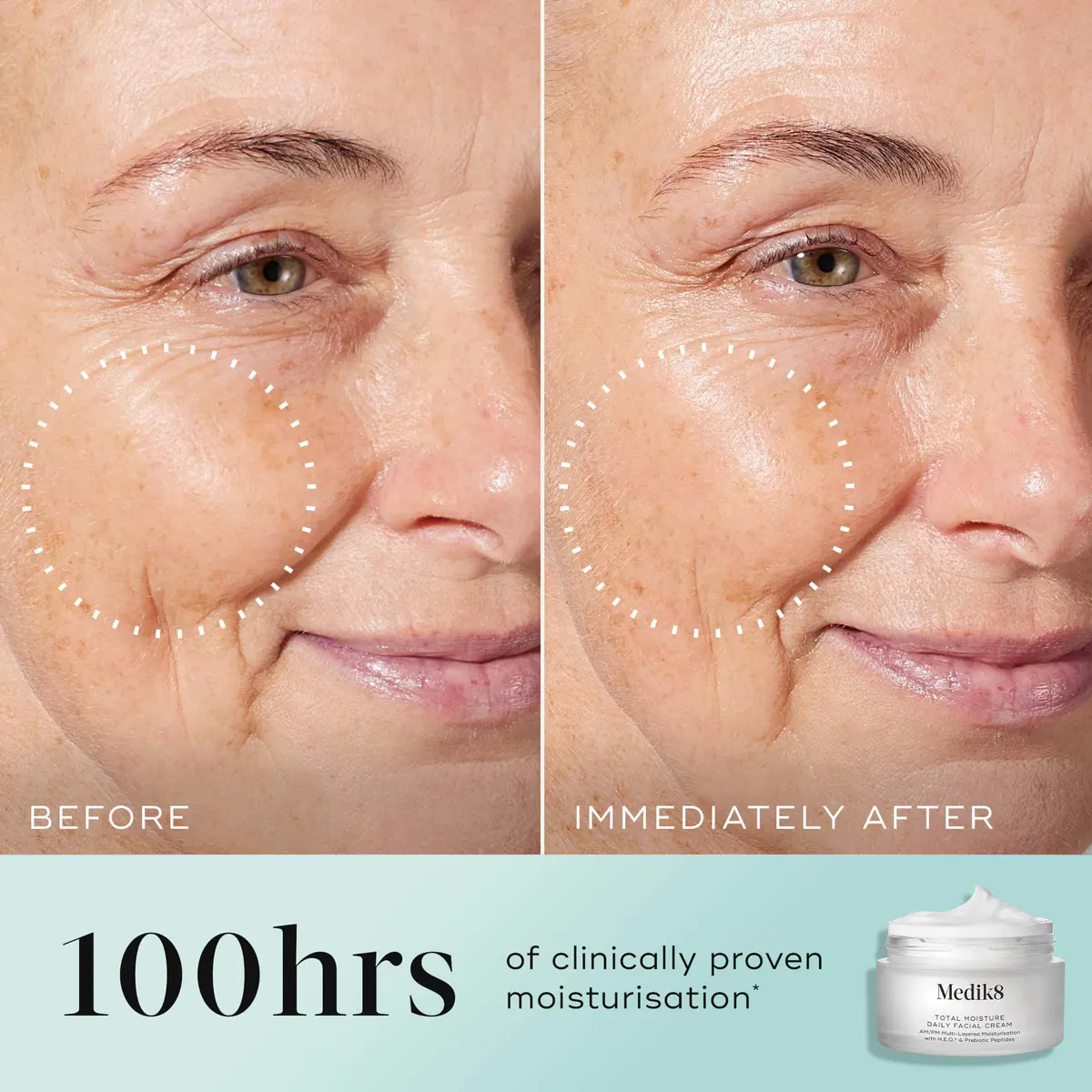 Medik8 Total Moisture Daily Facial Cream 50ml, view 3