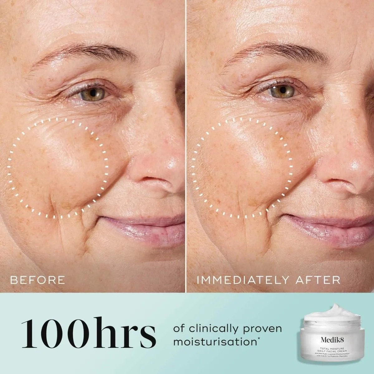 Medik8 Total Moisture Daily Facial Cream Refill 50ml, view 3
