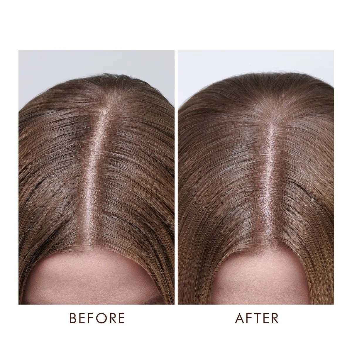 Moroccanoil Dry Scalp Treatment 45ml, view 2
