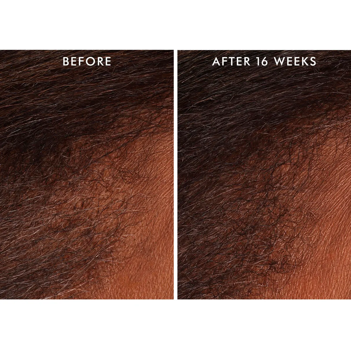Moroccanoil Scalp Tonic 100ml, view 4
