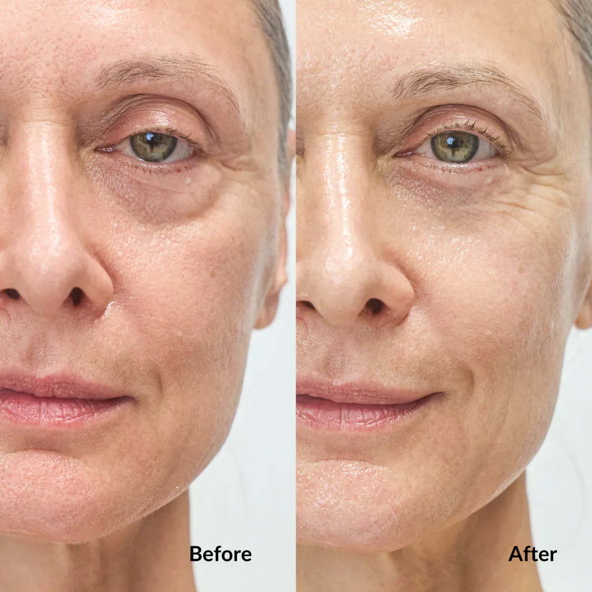 Ms Morning Bounce Back Sheet Mask - 1 Piece, view 2