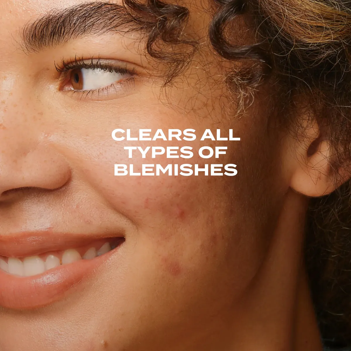 Murad Biome-Balancing Clear & Prevent Blemish Serum 30ml, view 3