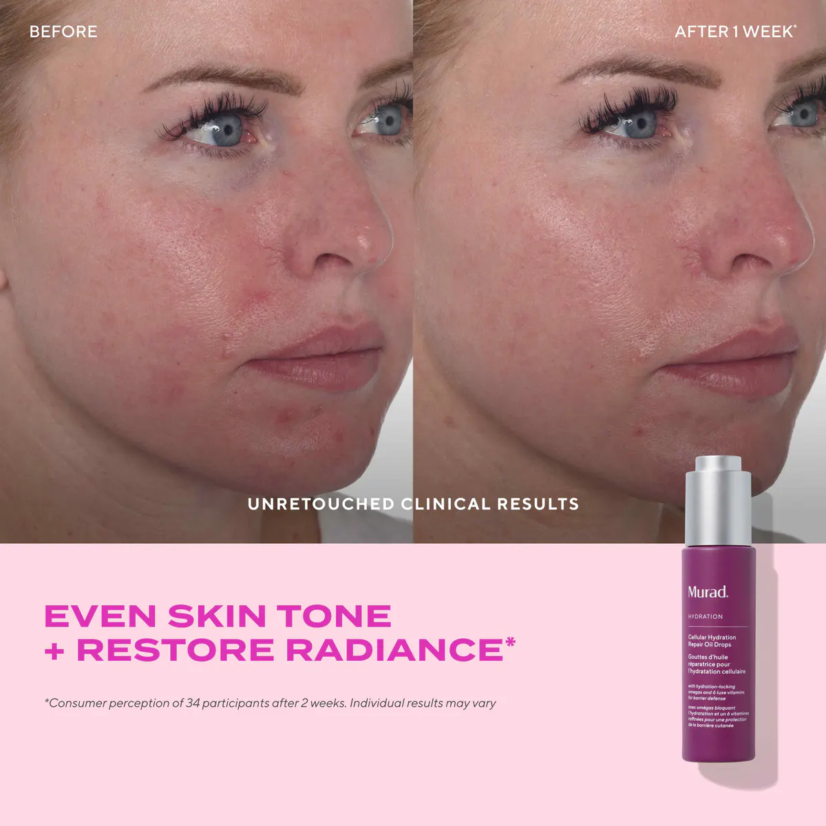 Murad Cellular Hydration Repair Oil Drops 30ml, view 3