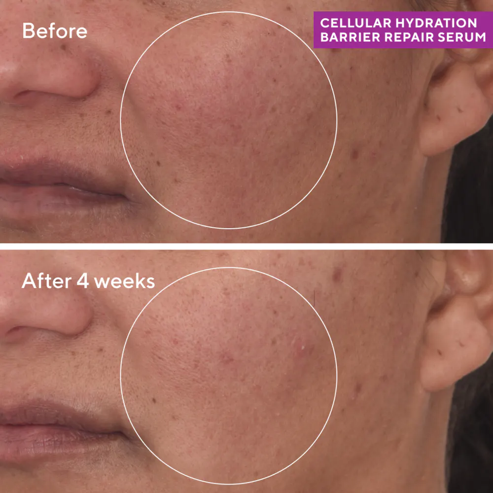 Murad Cellular Hydration Repair Serum 30ml, view 2
