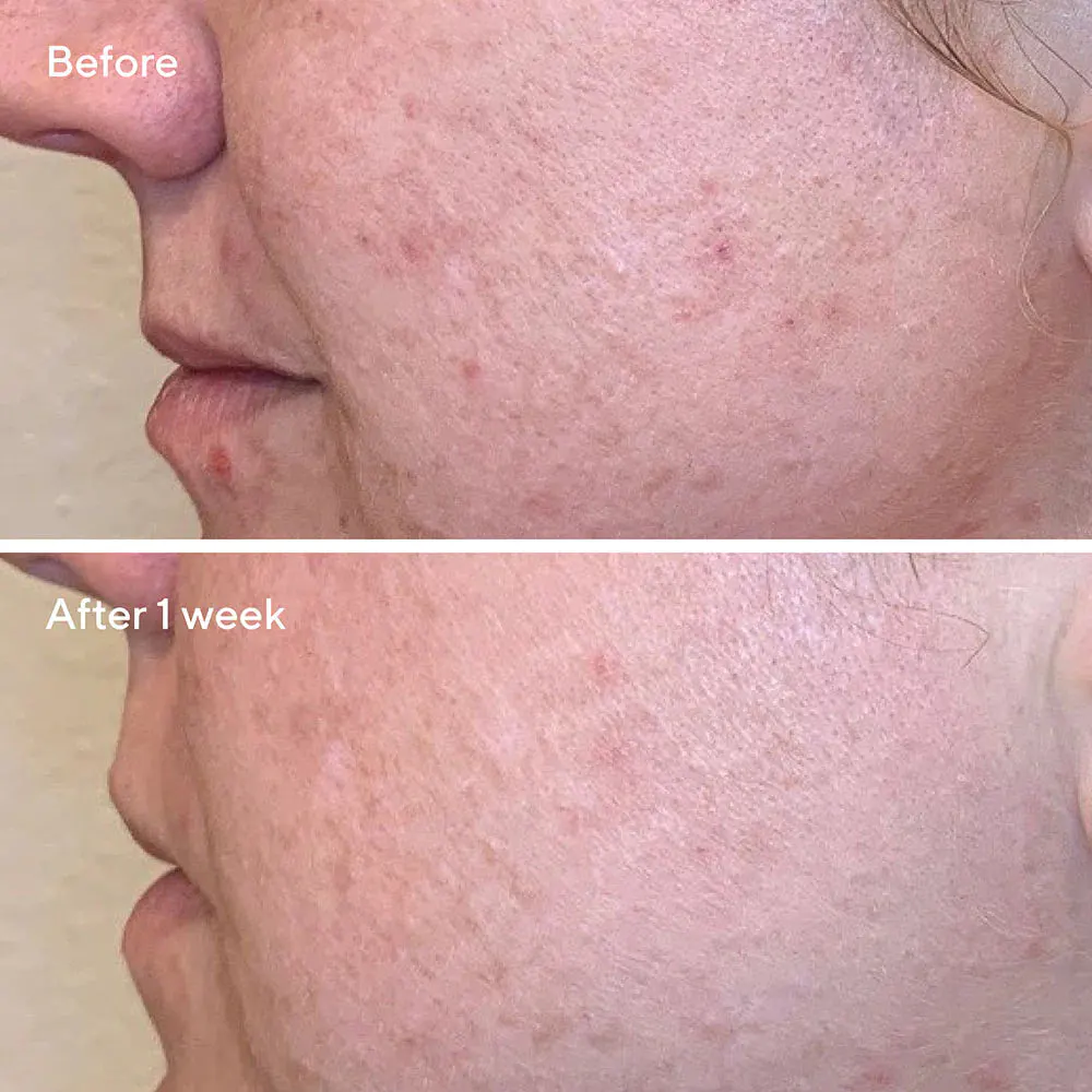 Murad Daily Clarifying Peel 95ml, view 2