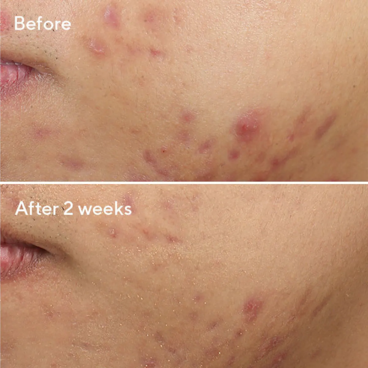 Murad Deep Relief Blemish Treatment 30ml, view 2