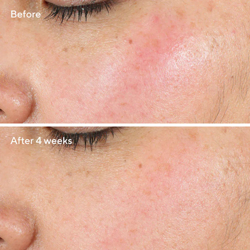 Murad Intense Recovery Cream 50ml, view 2