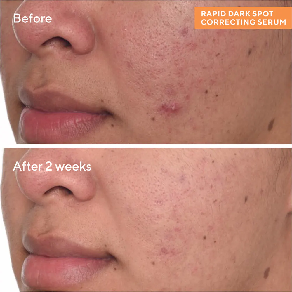 Murad Rapid Dark Spot Correcting Serum 30ml, view 2