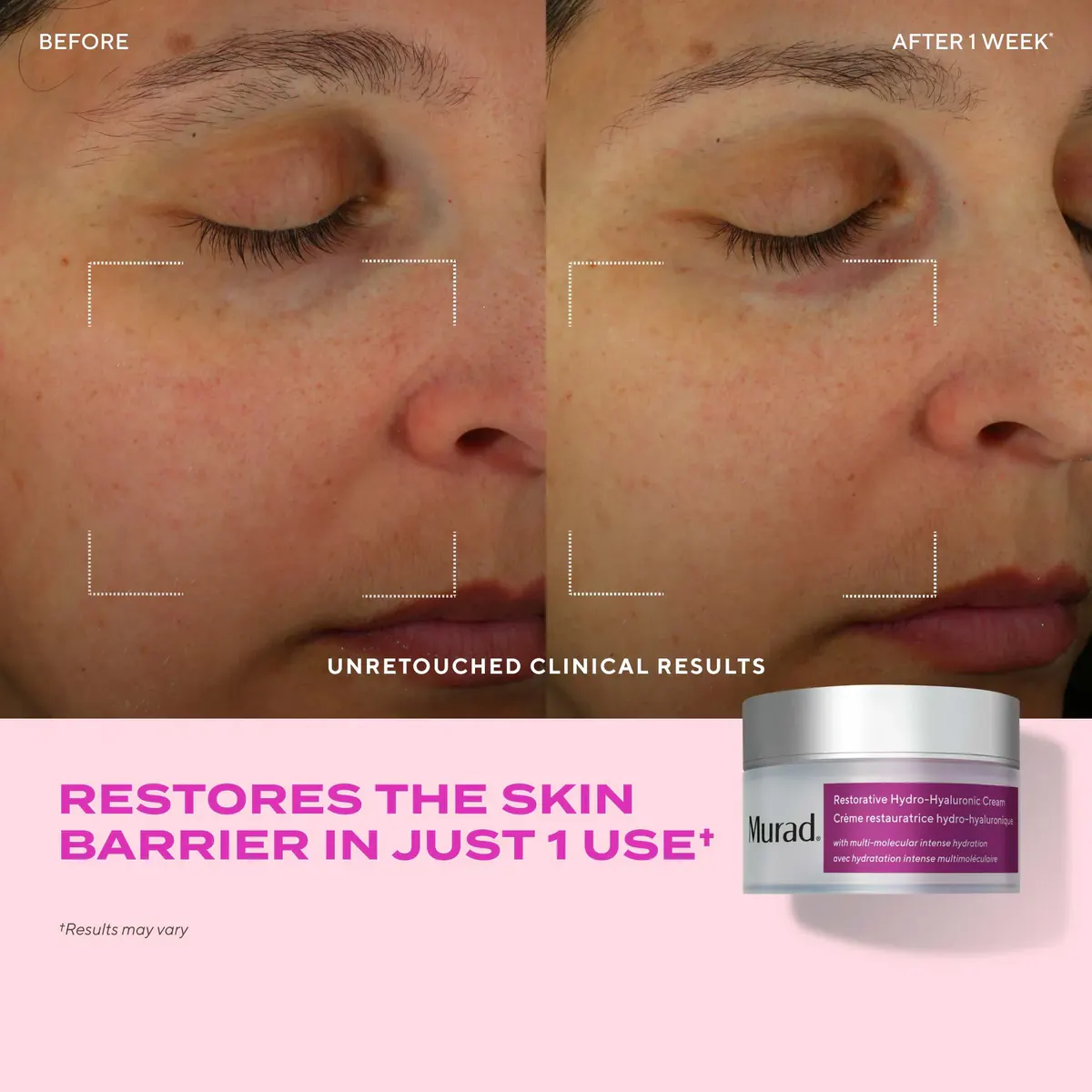 Murad Restorative Hydro-Hyaluronic Cream 50ml, view 2