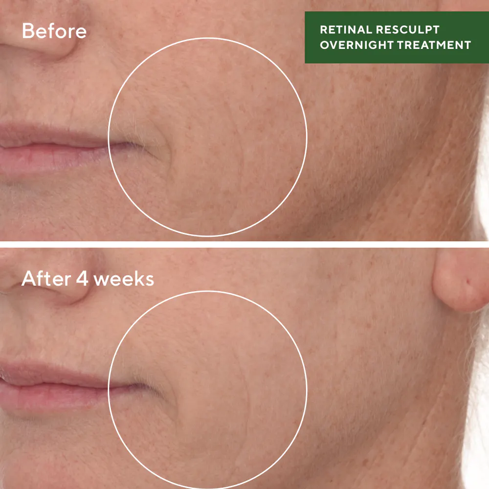 Murad Retinal ReSculpt Overnight Treatment 30ml, view 2
