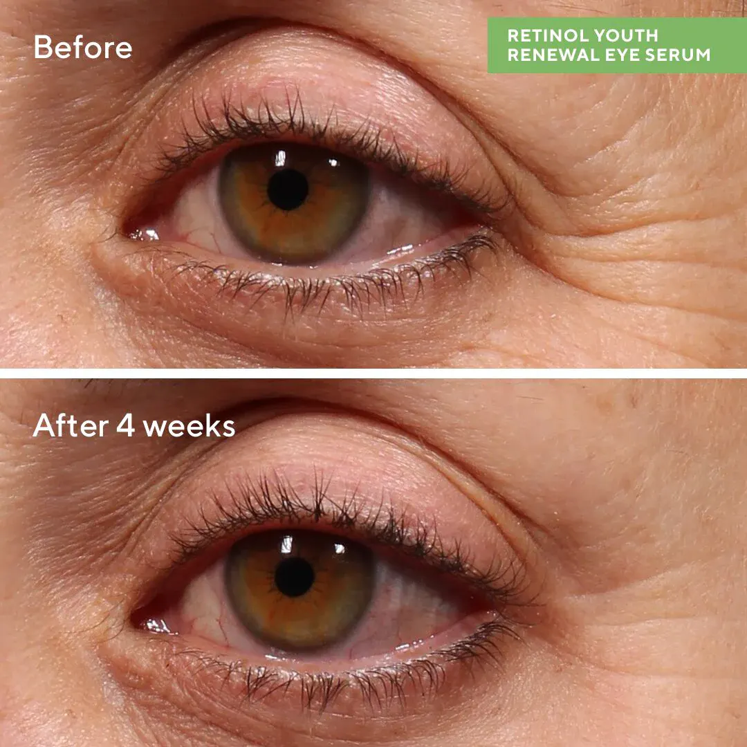 Murad Retinol Youth Renewal 360 Eye Serum 15ml, view 2