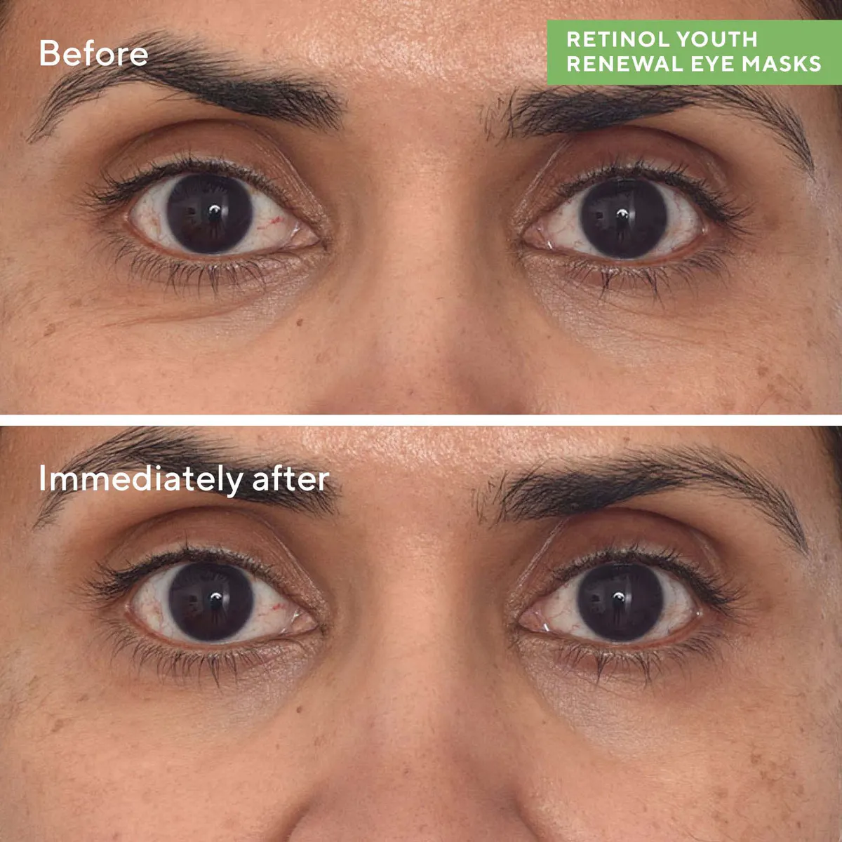 Murad Retinol Youth Renewal Eye Masks 5 Packs, view 2