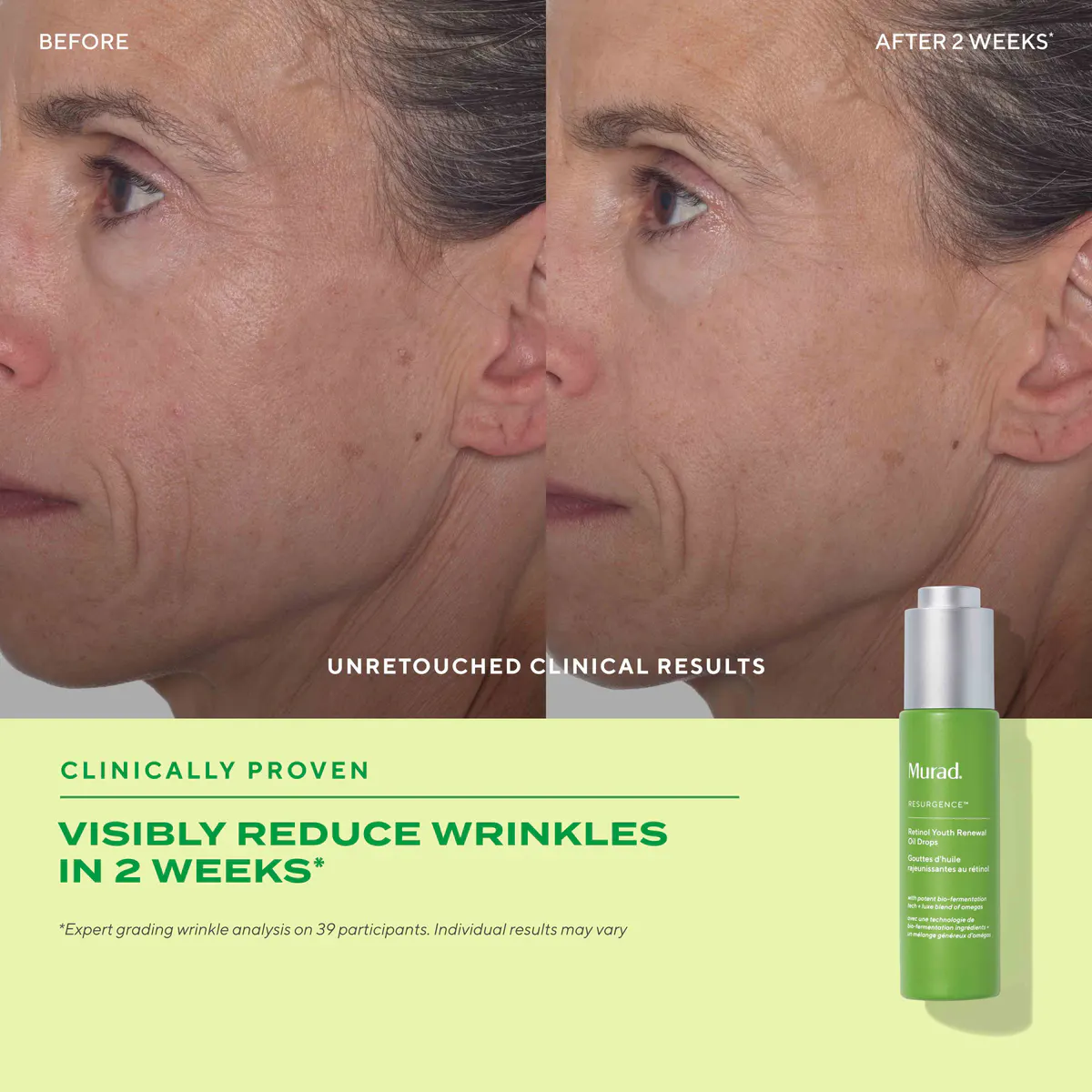 Murad Retinol Youth Renewal Face Oil Drops 30ml, view 2