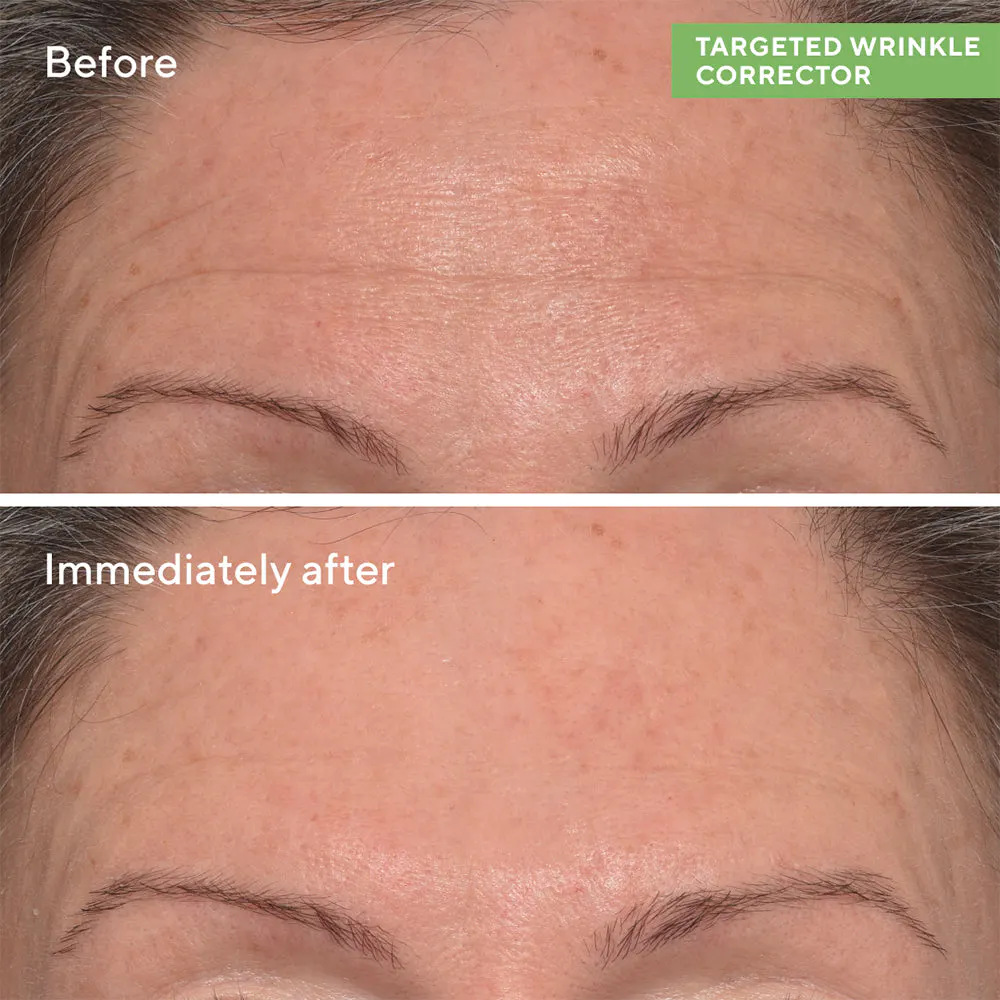 Murad Targeted Wrinkle Corrector 15ml, view 2