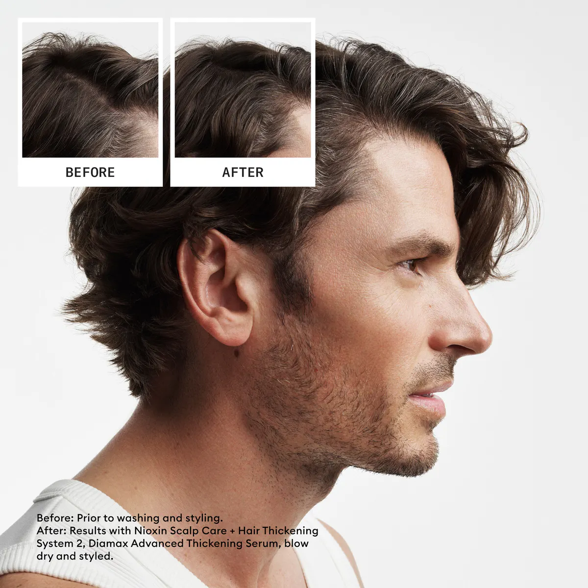 Nioxin Scalp + Hair Thickening System 2 Trio Pack, view 4