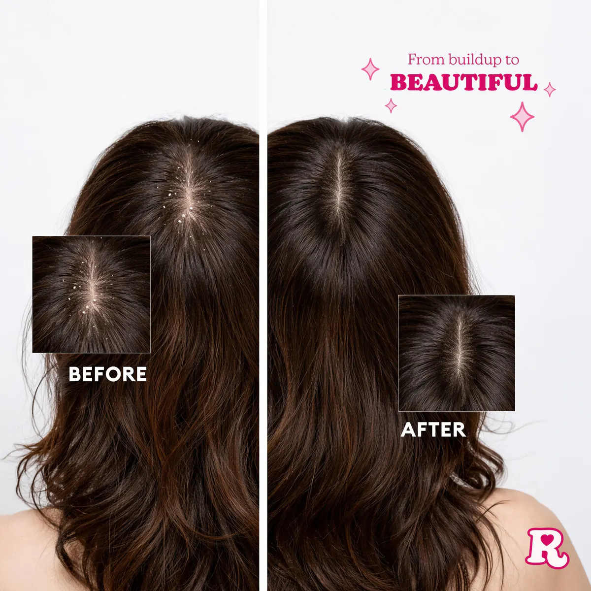 Redo Haircare Scratch That Scalp Brush, view 4