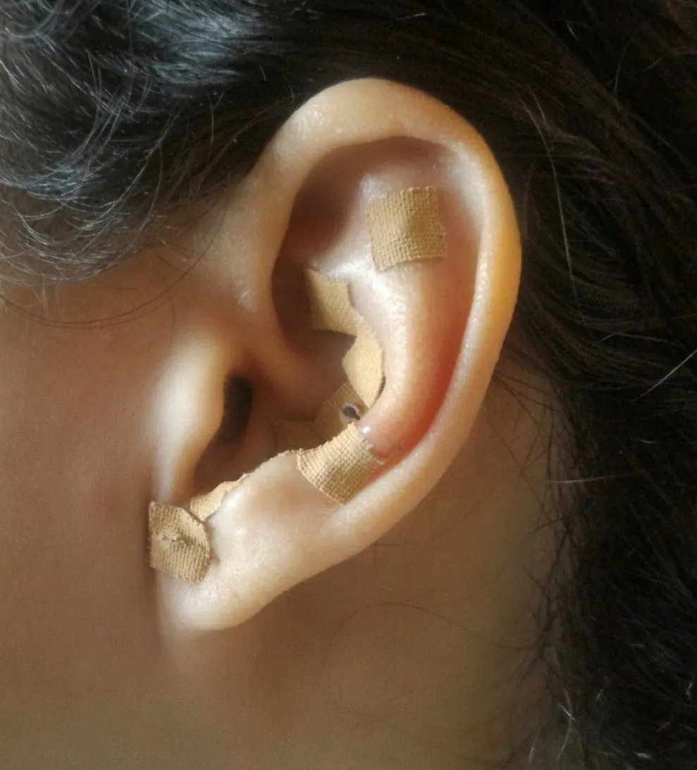 Seeded Ear Seeds 24k-Gold Magnetic Ear Seeds, view 2