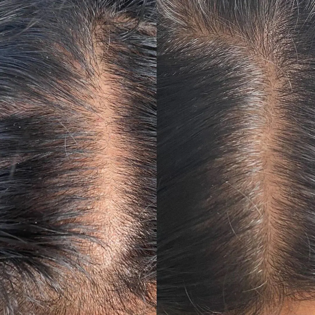 STRAAND 3 Step Scalp Soothe Bundle, view 5