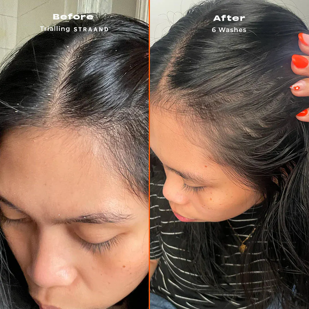 STRAAND The Scalp Care Starter Trio Pack, view 2