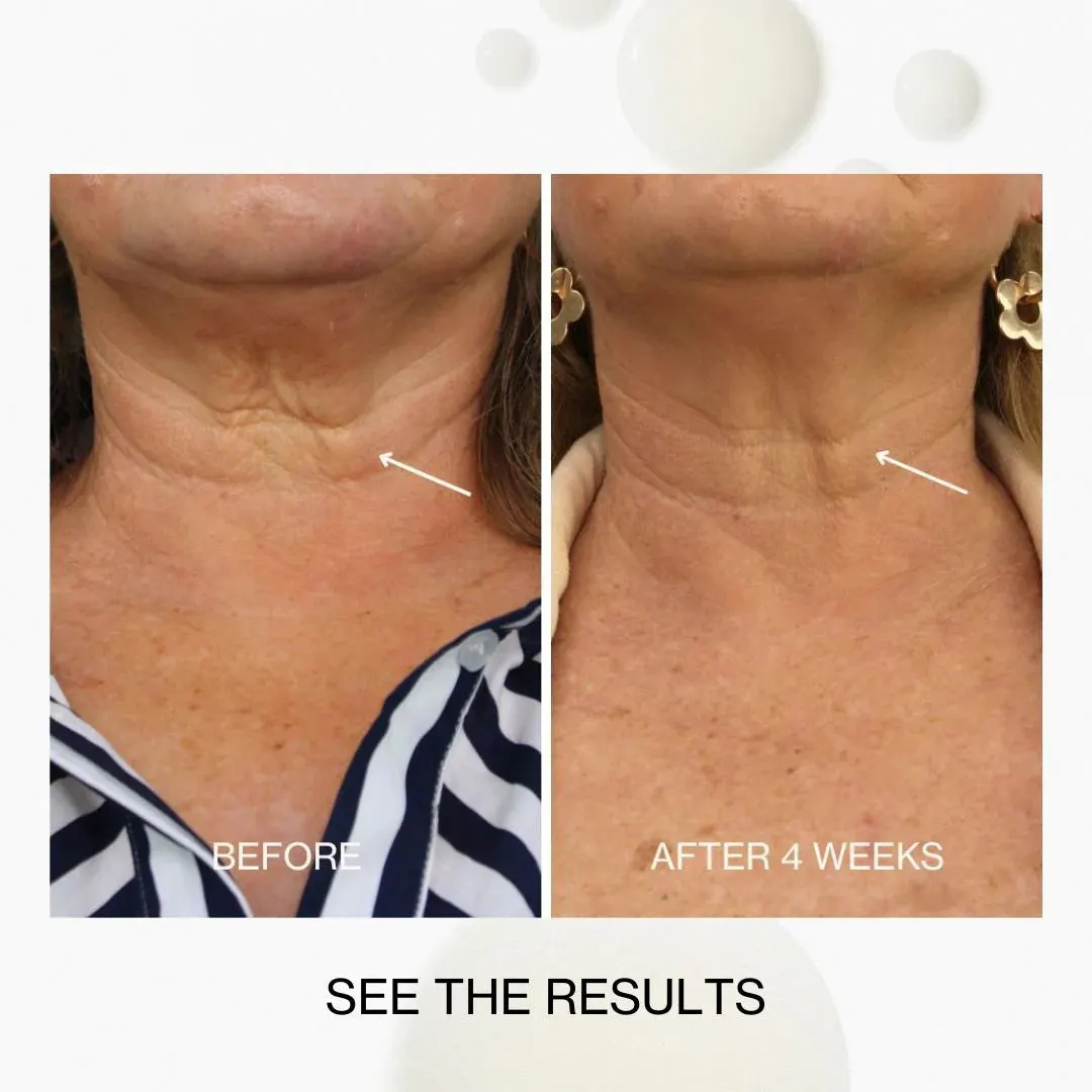 The Jojoba Company Neck & Décolletage Lifting Concentrate 30ml, view 3