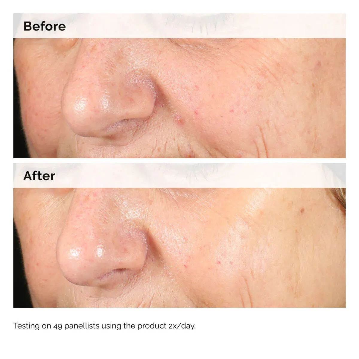 The Ordinary Alpha Arbutin 2% + HA 30ml, view 2