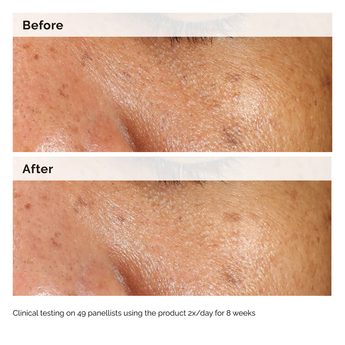 The Ordinary Alpha Arbutin 2% + HA 60ml, view 2