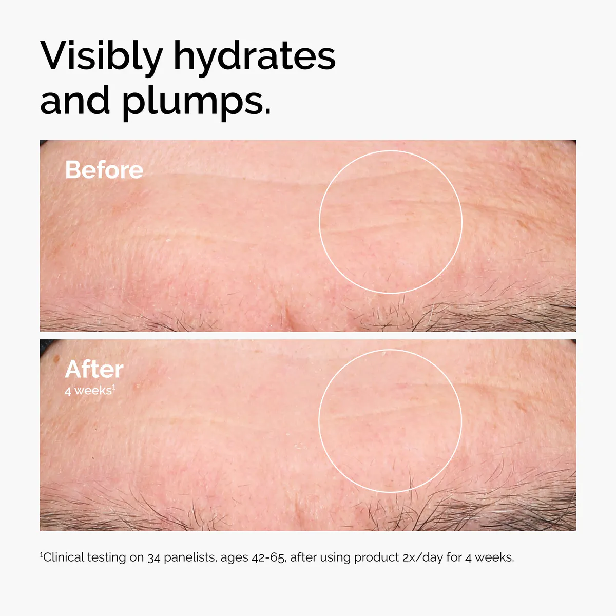 The Ordinary Hyaluronic Acid 2% + B5 60ml, view 2
