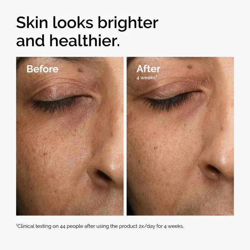 The Ordinary Multi-Antioxidant Radiance Serum 30ml, view 4