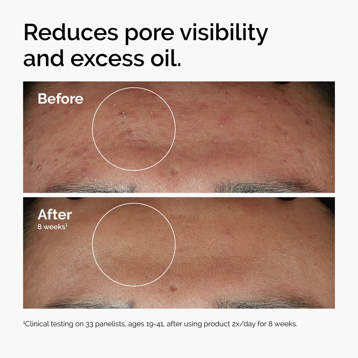 The Ordinary Niacinamide 10% + Zinc 1% 60ml, view 2