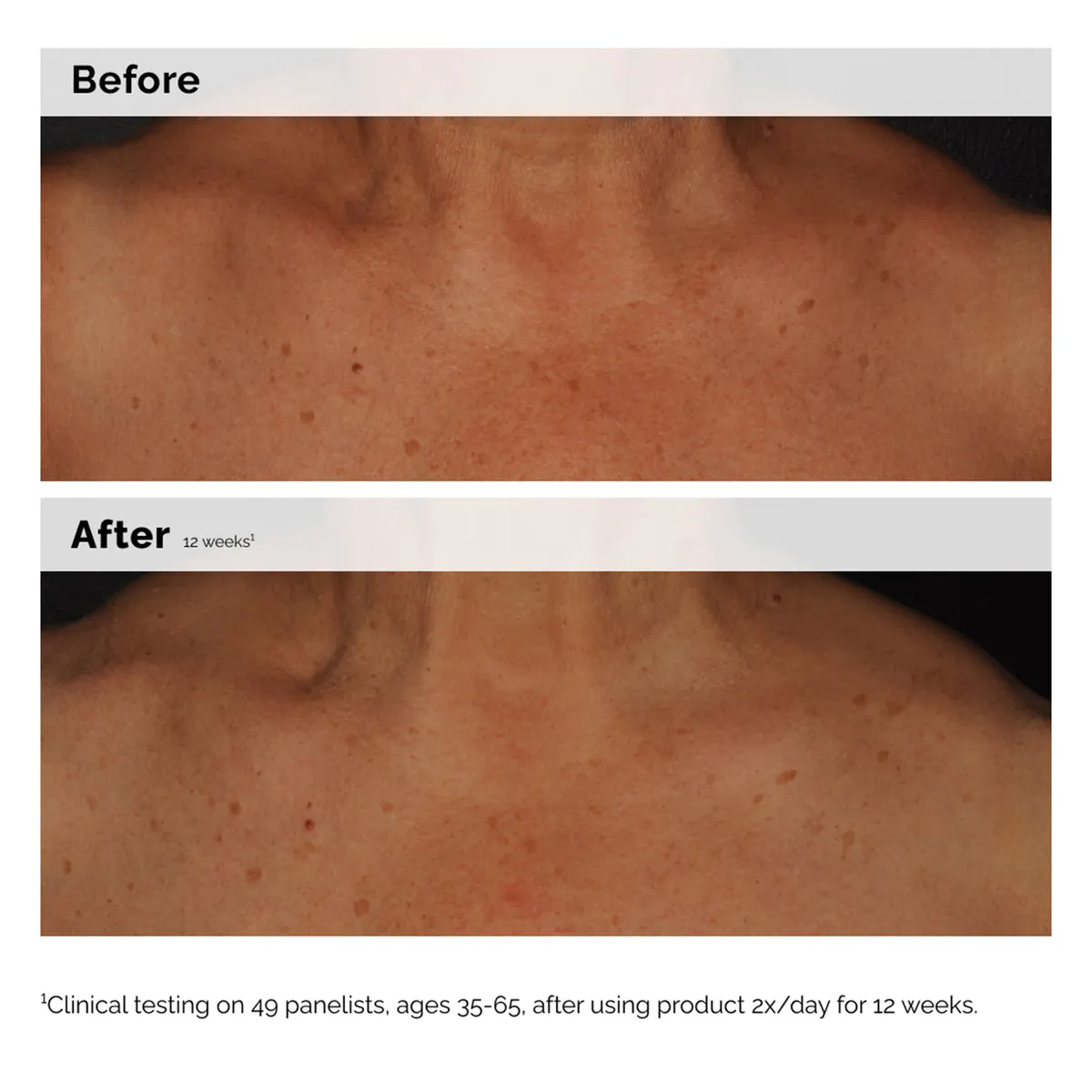 The Ordinary Niacinamide 5% Face and Body Emulsion 100ml, view 2