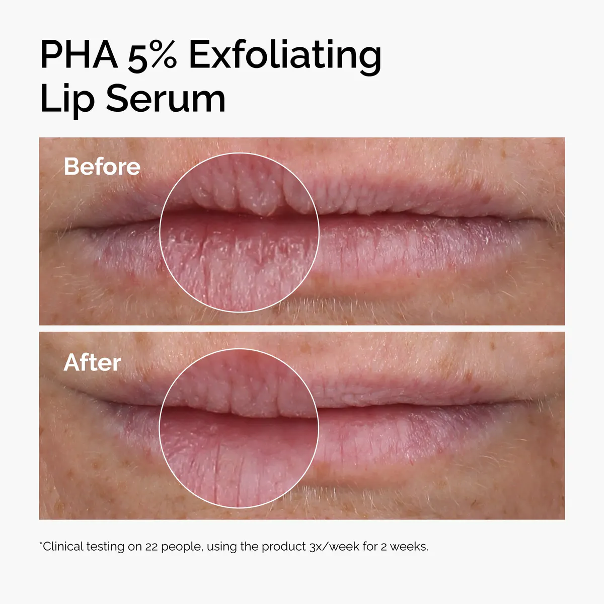 The Ordinary PHA 5% Exfoliating Lip Serum 15ml, view 3