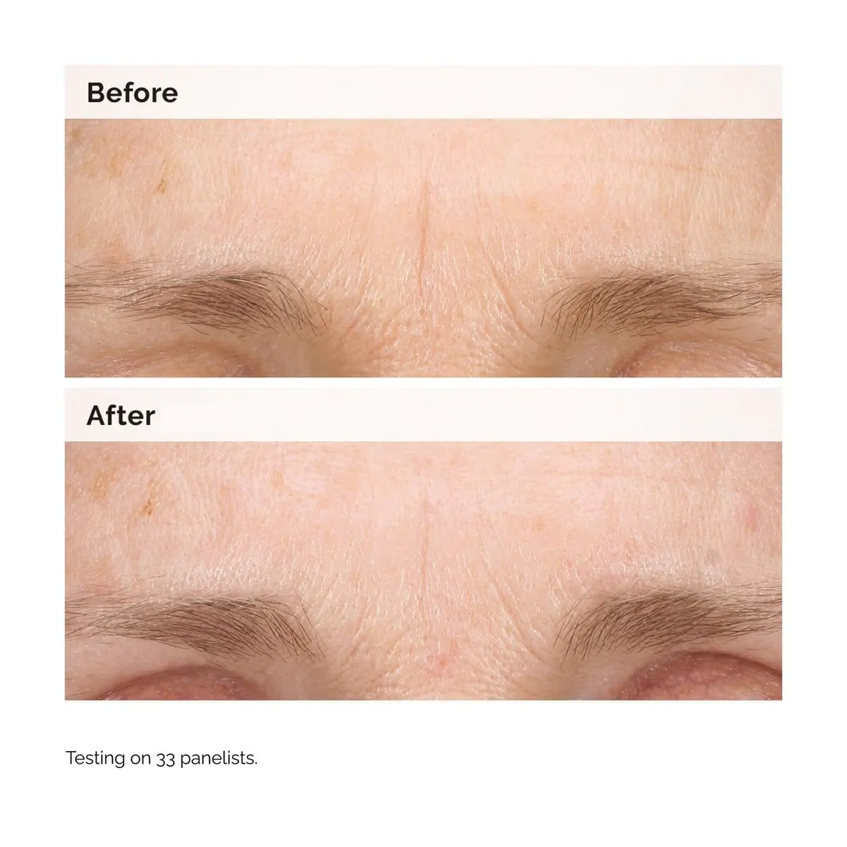 The Ordinary Retinal 0.2% Emulsion 15ml, view 2