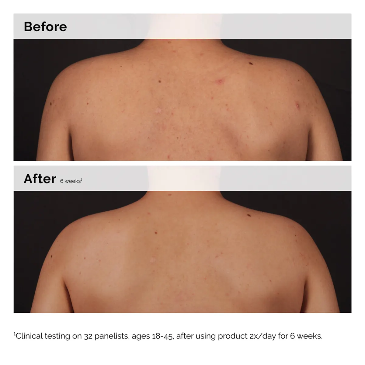 The Ordinary Salicylic Acid 0.5% Body Serum 240ml, view 2