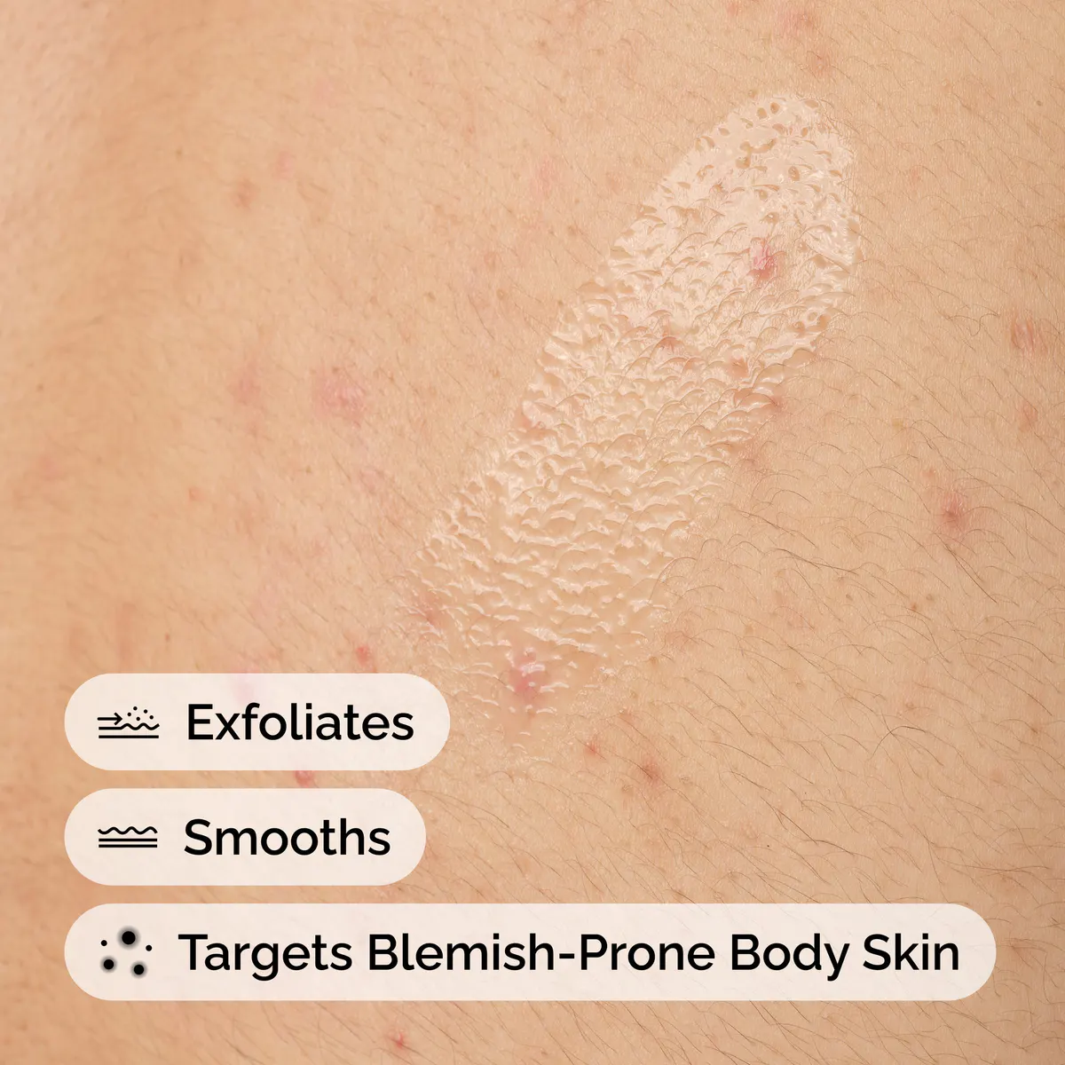The Ordinary Salicylic Acid 0.5% Body Serum 240ml, view 4