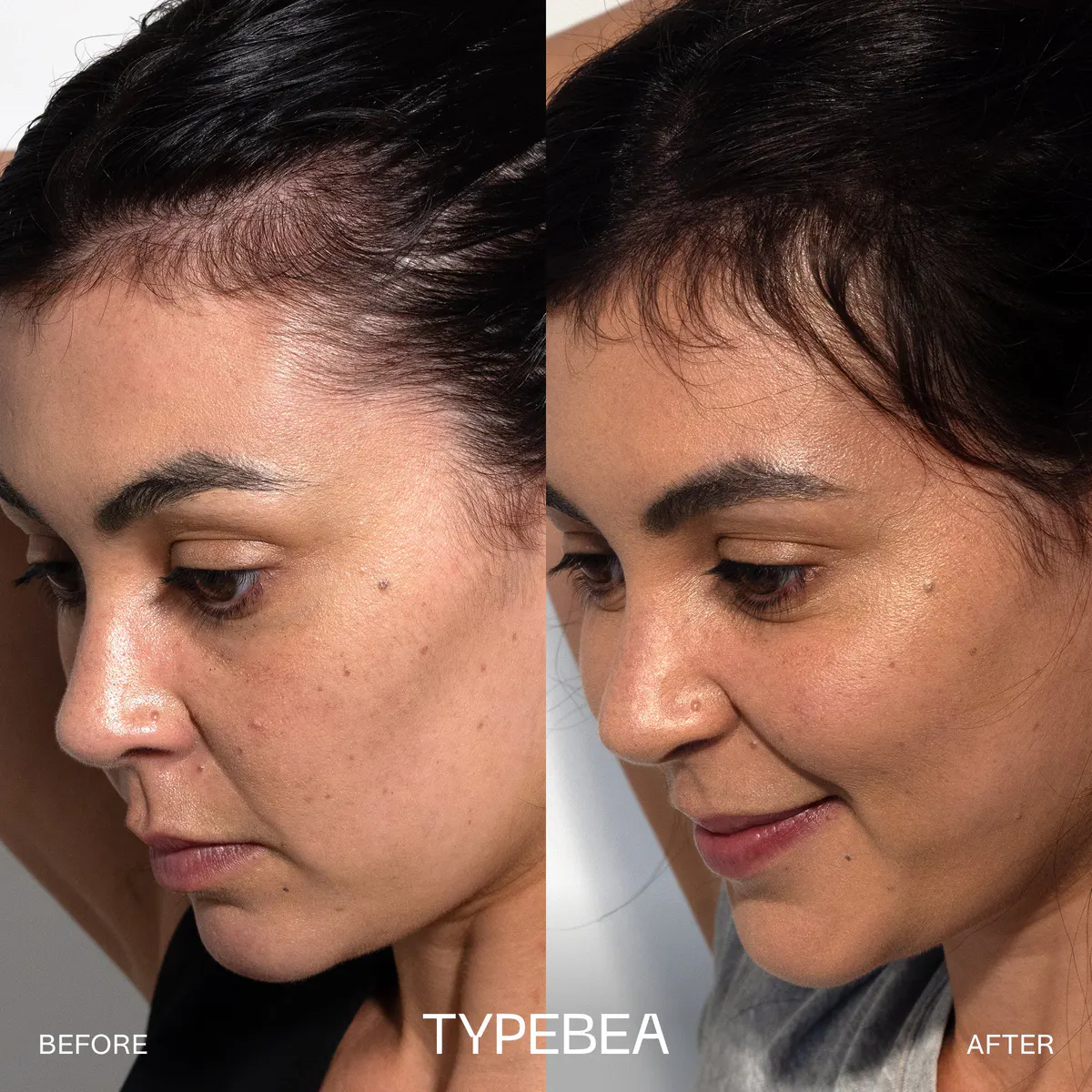 TYPEBEA G1 Overnight Boosting Peptide Serum 100ml, view 4