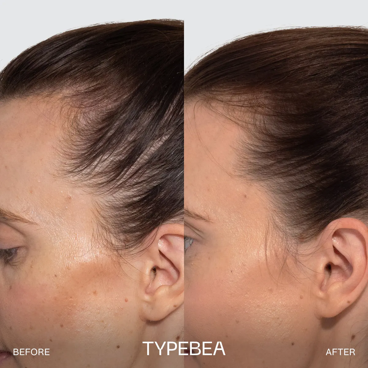 TYPEBEA G1 Overnight Boosting Peptide Serum 10ml, view 3