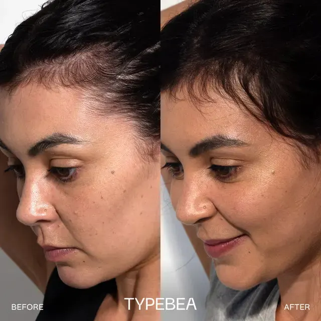 TYPEBEA Grow + Repair Duo Bundle, view 2