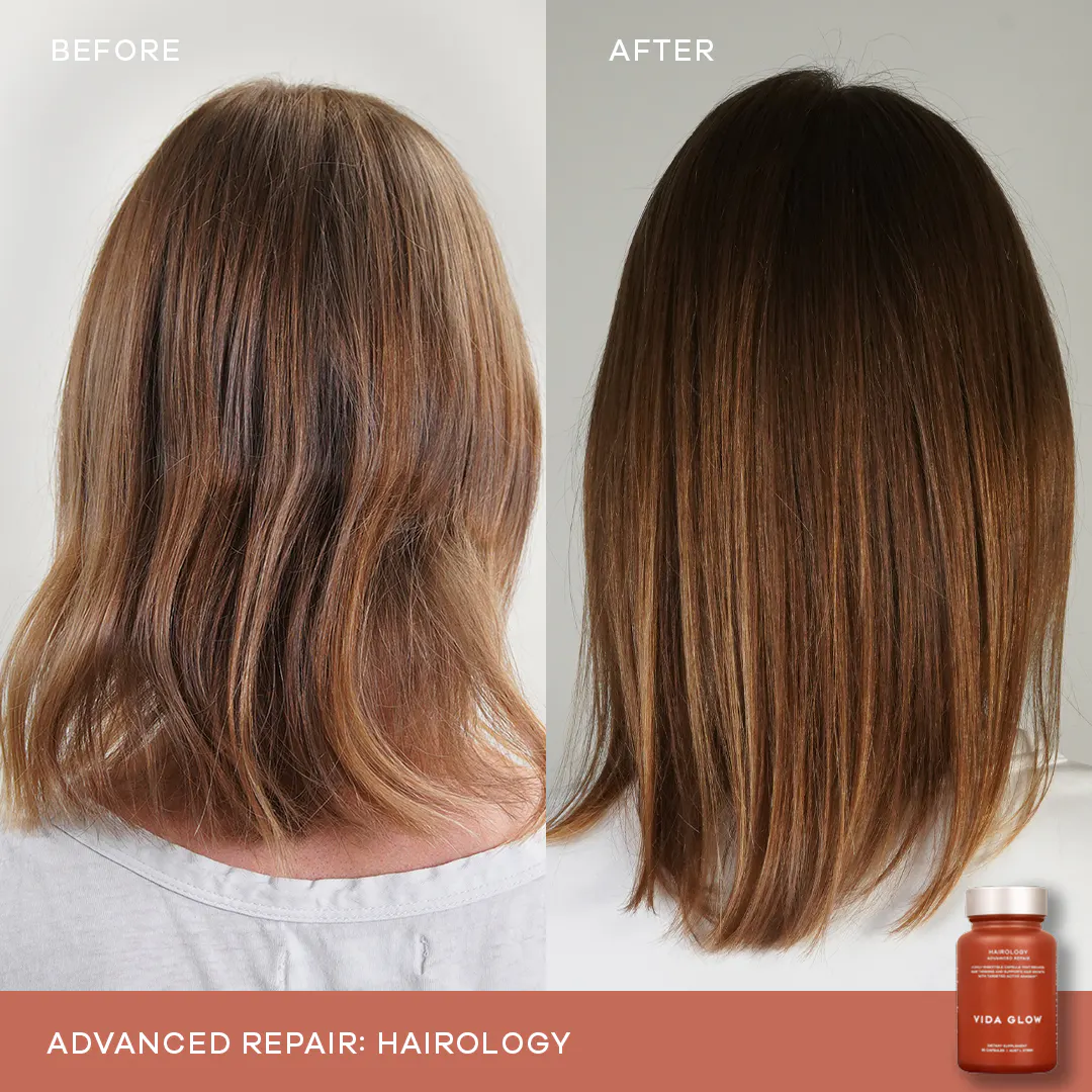 Vida Glow Advanced Hair + Skin Bundle, view 2
