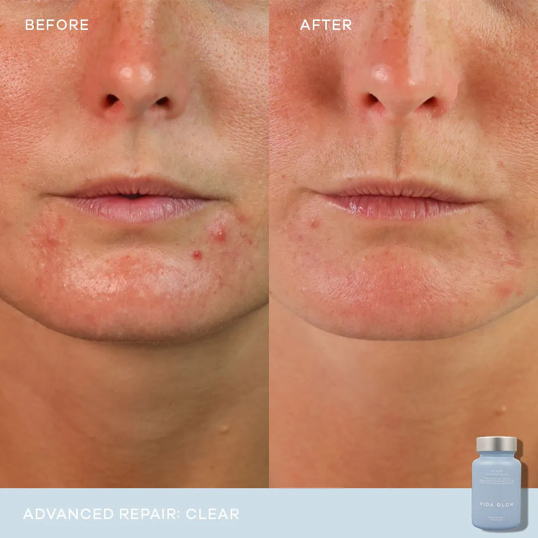Vida Glow Clear Advanced Repair- 30 Capsules, view 3
