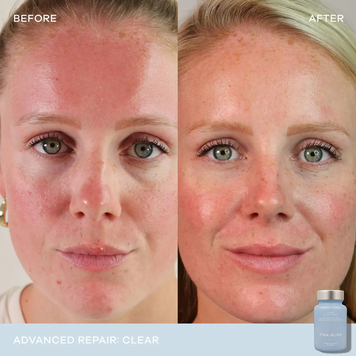 Vida Glow Clear Advanced Repair- 30 Capsules, view 4