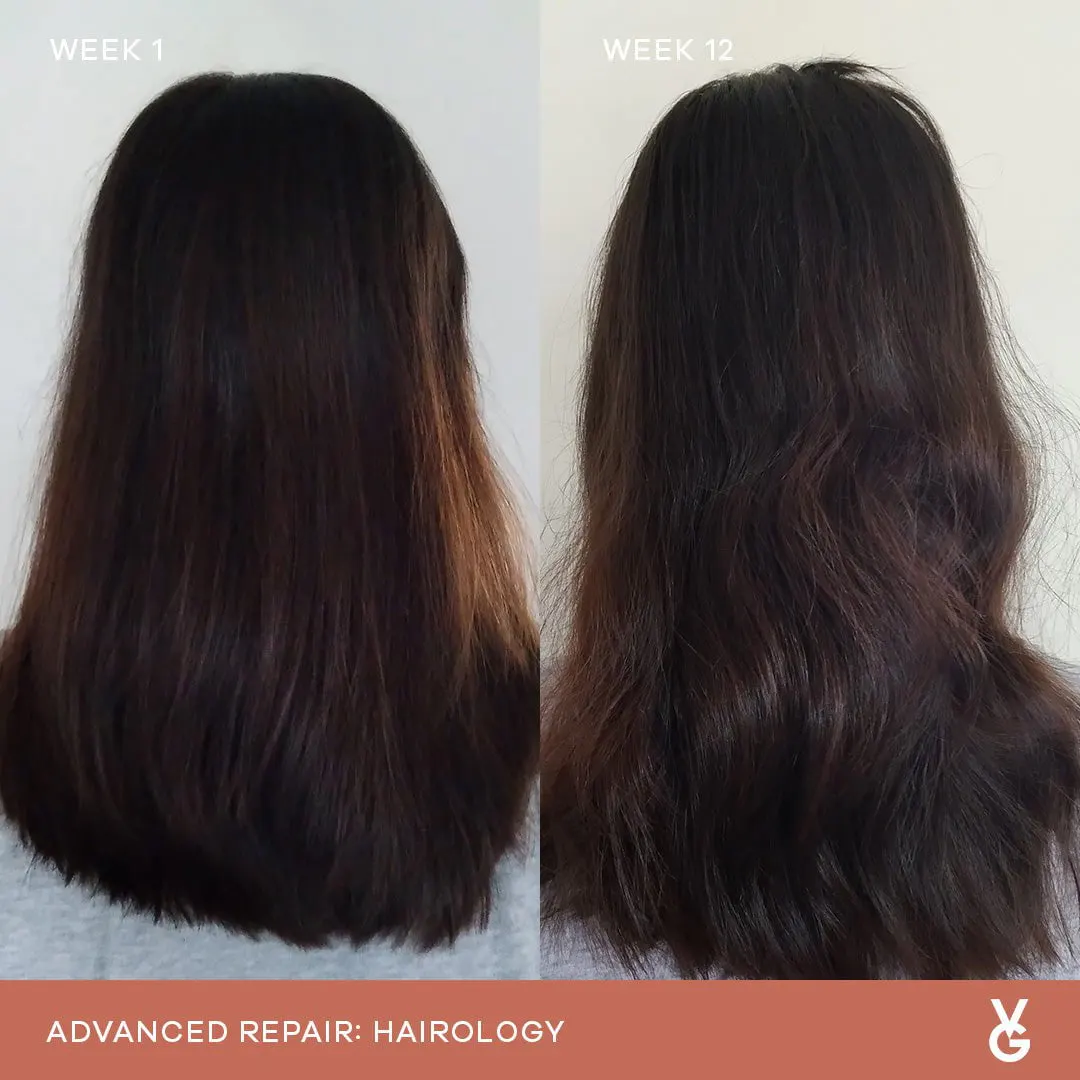 Vida Glow Hair Revival Duo Bundle, view 2