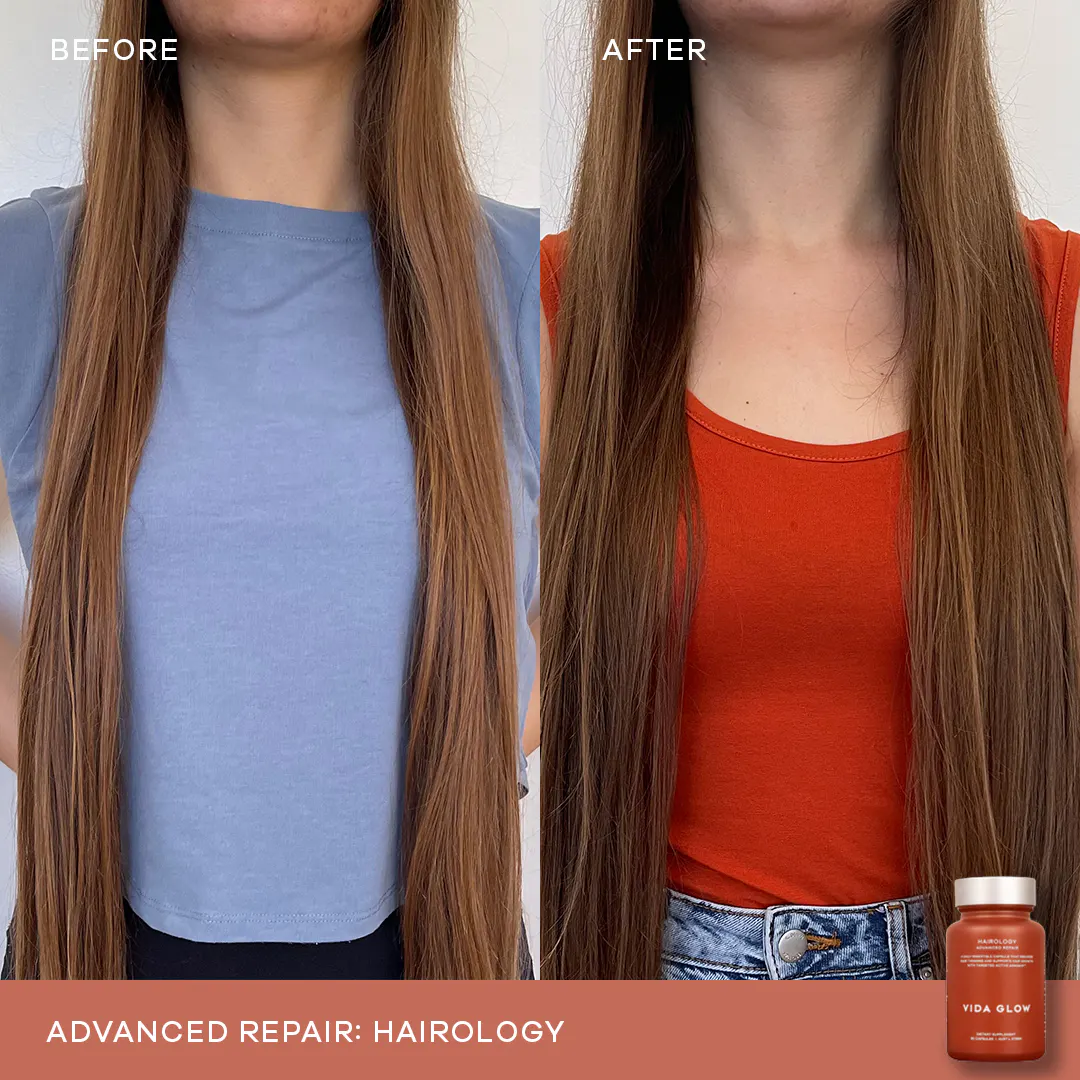 Vida Glow Hairology Advanced Repair - 30 Capsules, view 2