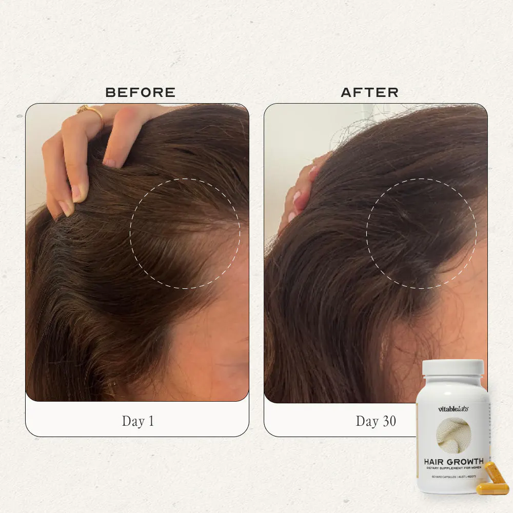 VitableLabs Hair Growth - 60 Capsules, view 3